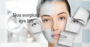 non surgical eye lift