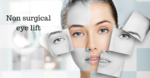 non surgical eye lift Dublin Happy Woman Clinic